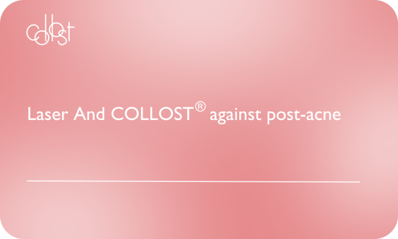 Laser and COLLOST® against post-acne