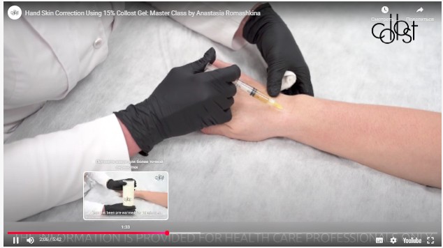 Workshop on Hand Skin Correction Using COLLOST® 15% Gel