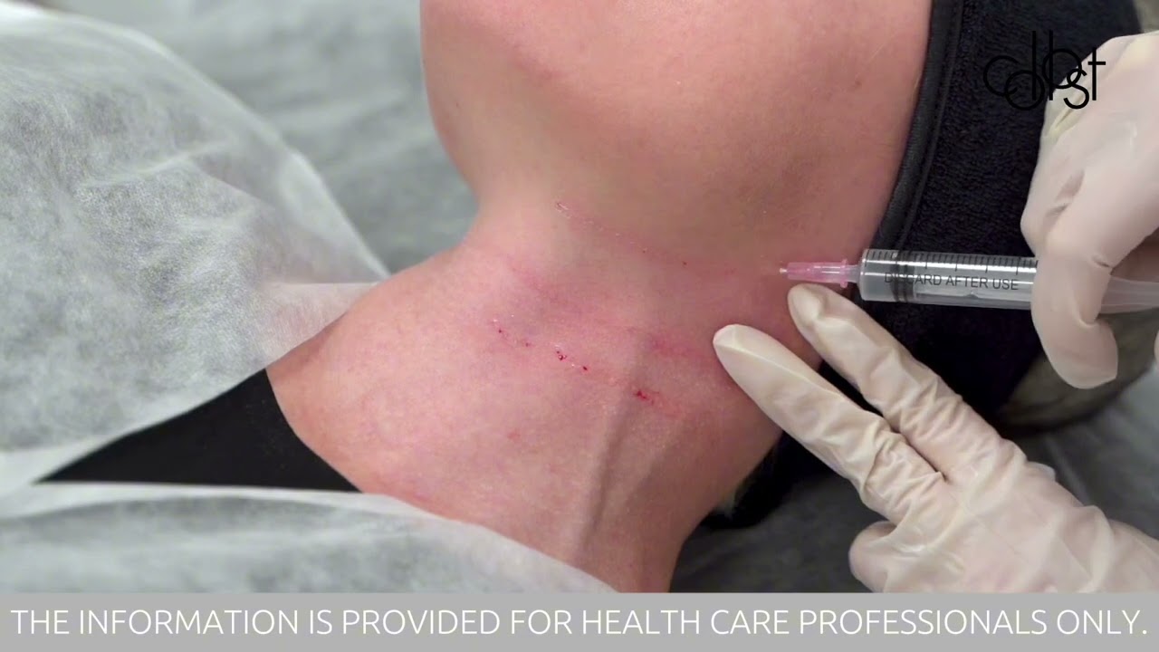 Workshop on Wrinkle Correction on the Neck Using COLLOST®