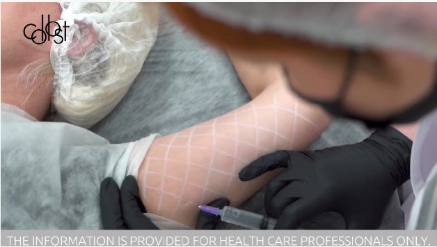 Workshop on Correction of Age-Related Hand Changes Using COLLOST® gel