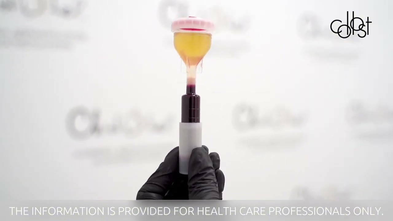 Workshop on Correction of Stretch Marks Using COLLOST® micro and PRP